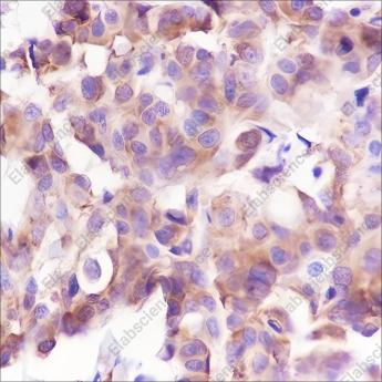 Recombinant Phospho-S6 Ribosomal Protein (Ser240, 244) Monoclonal Antibody - 2