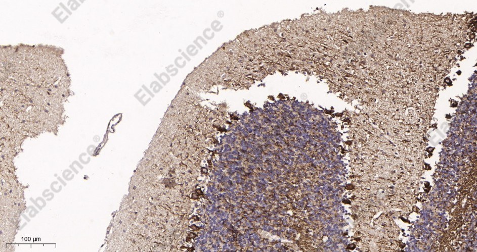 Recombinant Neurofilament heavy polypeptide Monoclonal Antibody - 3