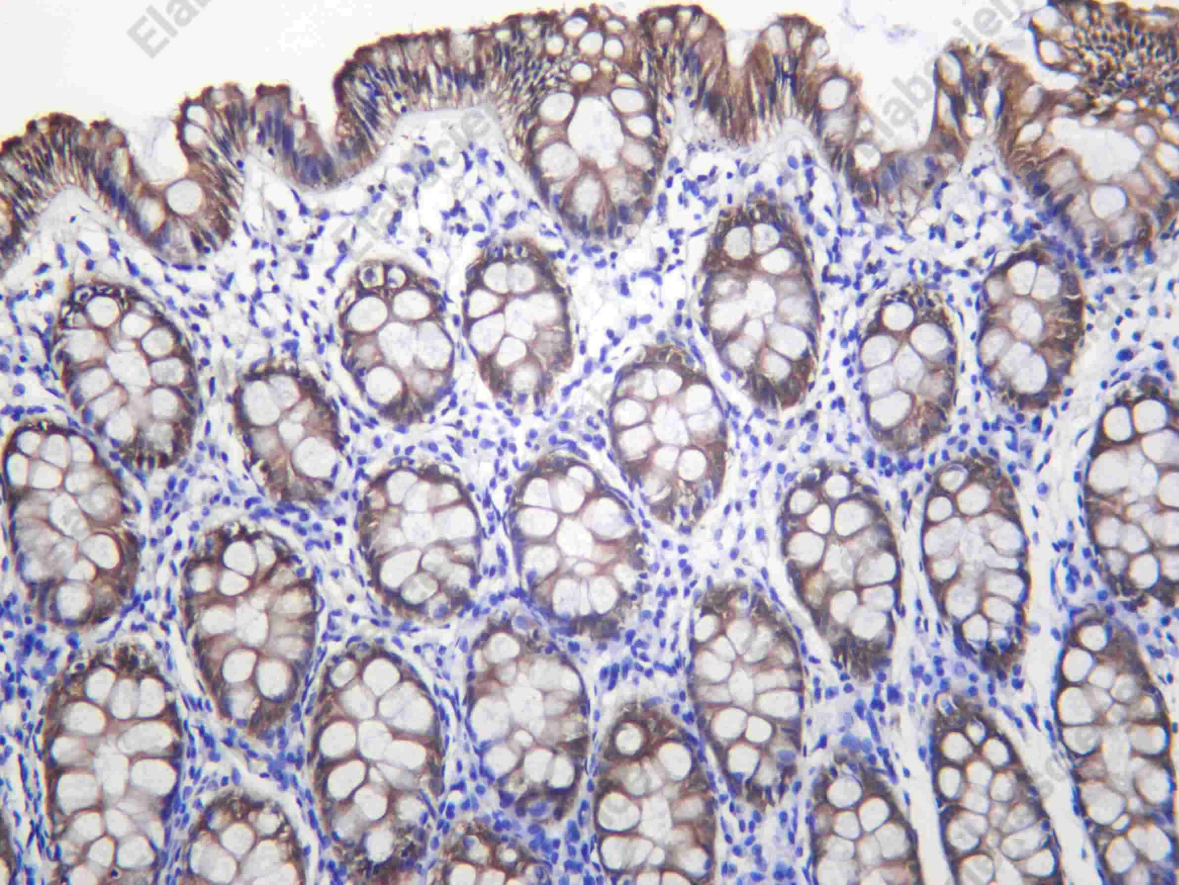 Recombinant PADI2 Monoclonal Antibody - 1