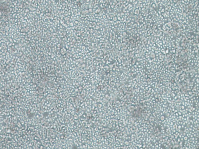 SU-DHL-2 Cell Complete Medium - 3