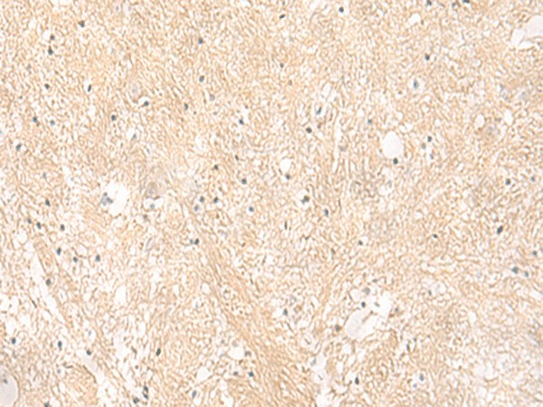 Immunohistochemistry of paraffin-embedded Human brain tissue  using EMC1 Polyclonal Antibody at dilution of 1:35(?200)