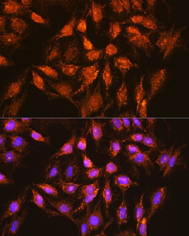 Immunofluorescence analysis of C6 cells using BCL2L1 Polyclonal Antibody at dilution of  1:100 (40x lens). Blue: DAPI for nuclear staining.