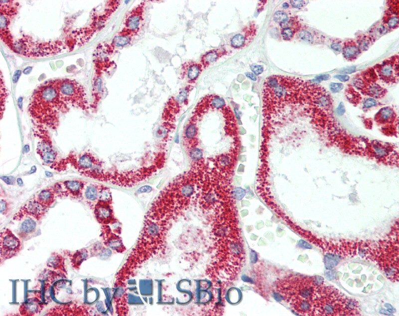 Immunohistochemistry of paraffin-embedded Human Kidney using HSD17B8 Polyclonal Antibody at dilution of 1:100(Elabscience Product Detected by Lifespan).