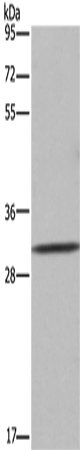 Western Blot analysis of 231 cell using ASGR1 Polyclonal Antibody at dilution of 1:300