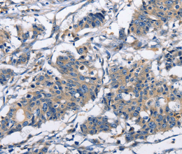 CAPZA2 Polyclonal Antibody - 3