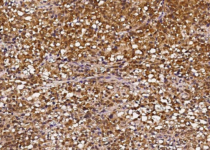 Recombinant HSP70/HSPA1A Monoclonal Antibody - small - 2