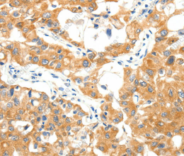 TRAF3 Polyclonal Antibody - 3
