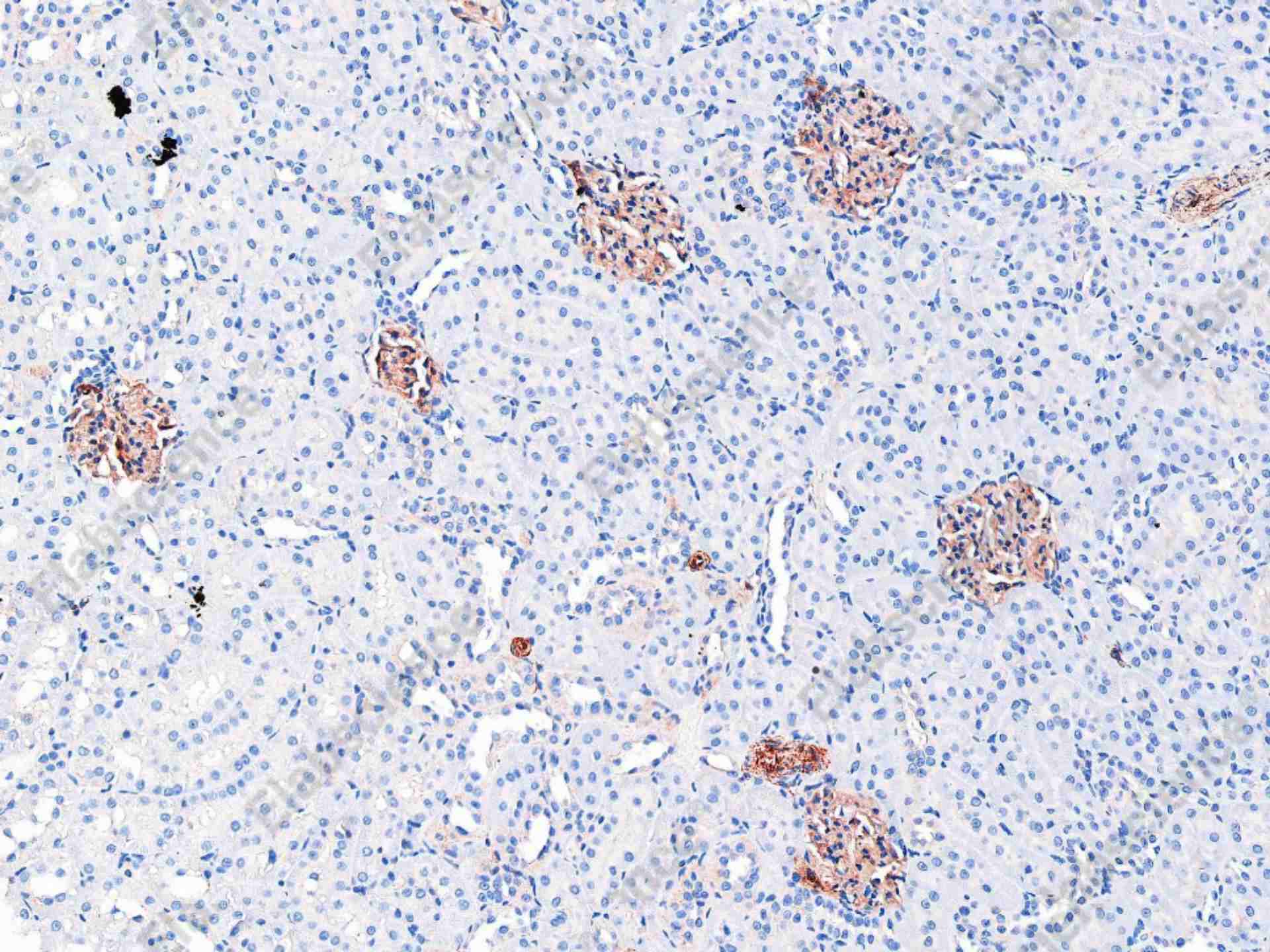 Recombinant ZO1 Monoclonal Antibody - 1