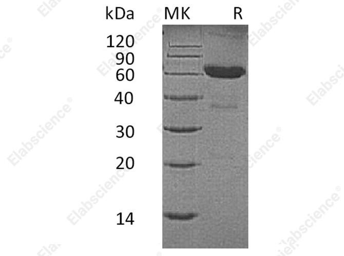 Recombinant Human CD7/GP40 Protein (Fc Tag) - 1