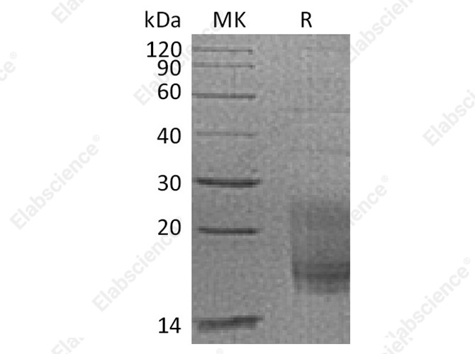 Recombinant Cynomolgus TIGIT/VSIG9/VSTM3 Protein (His Tag) - 1