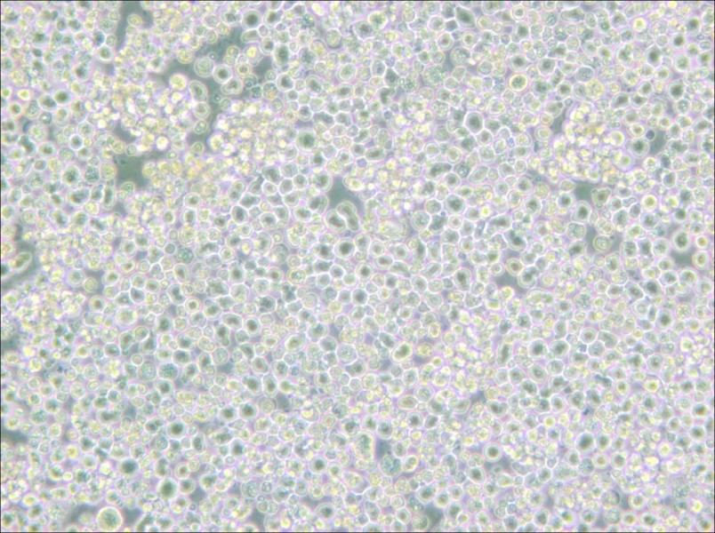 PC 61 5.3 [PC 61; PC 61.5.3] Cell Complete Medium - small - 6