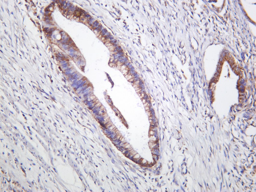 Recombinant Phospho-mTOR (Ser2448) Monoclonal Antibody - small - 4