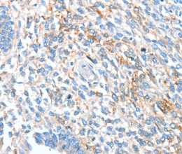 ALDH1A2 Polyclonal Antibody - 2