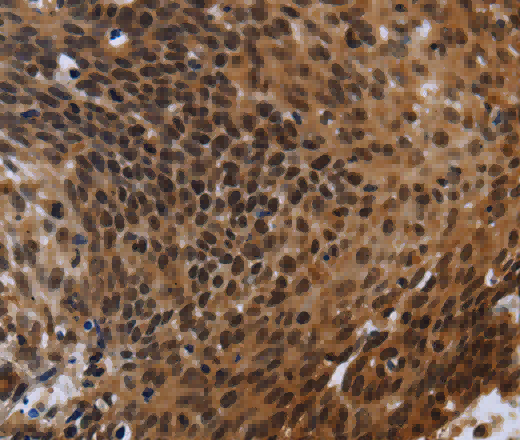 FHL3 Polyclonal Antibody - 2