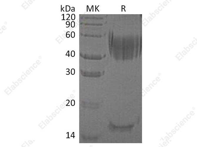 Recombinant Human Haptoglobin/Zonulin Protein (His Tag) - 1