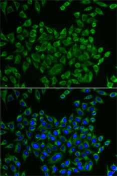 Immunofluorescence analysis of U2OS cells using MRPS30 Polyclonal Antibody Blue: DAPI for nuclear staining.