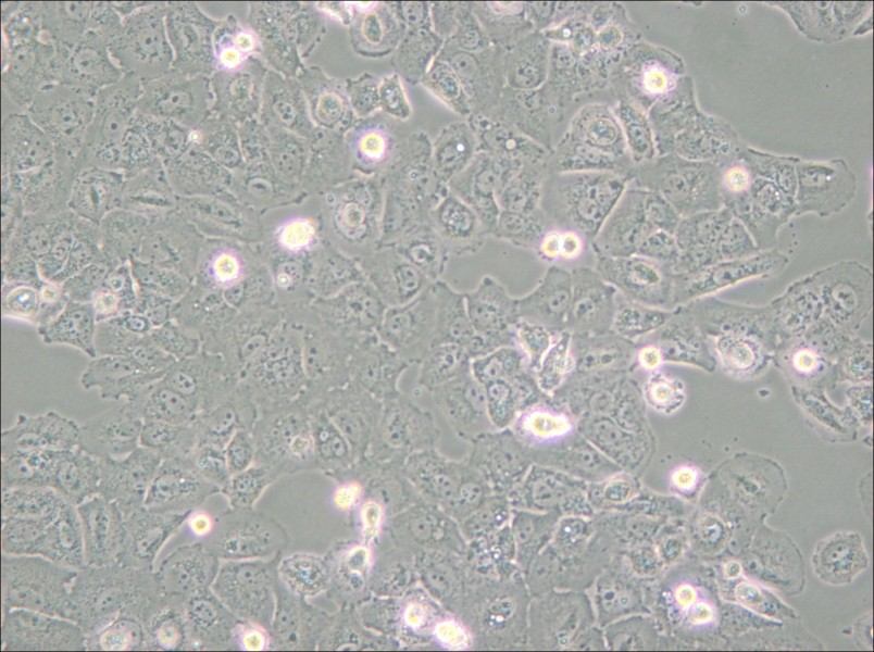 Caov-3 Cell Complete Medium - small - 6