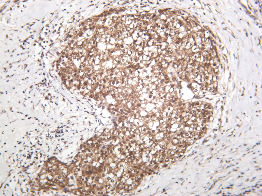 Recombinant ERK1/2 Monoclonal Antibody - 3