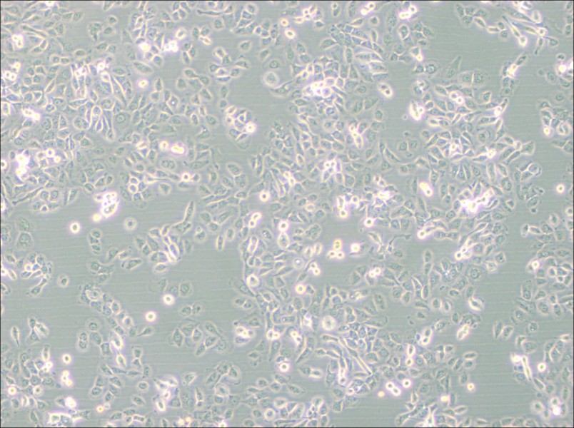 SUM149PT Cell Complete Medium - 3