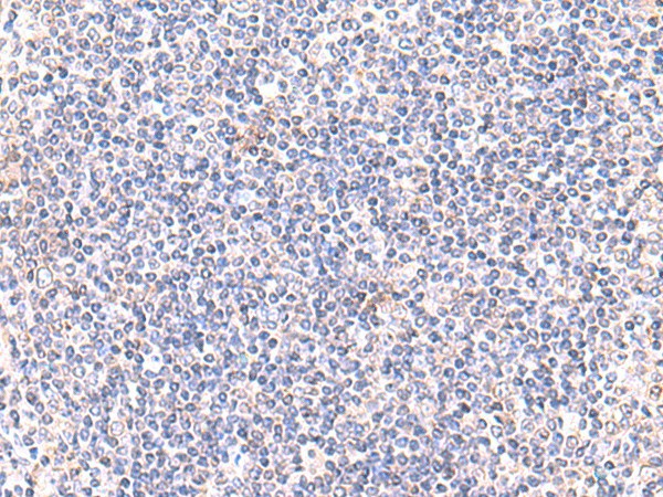 Immunohistochemistry of paraffin-embedded Human tonsil tissue  using IFT57 Polyclonal Antibody at dilution of 1:85(?200)