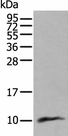 Western blot analysis of Human lung tissue lysate  using CCL18 Polyclonal Antibody at dilution of 1:400