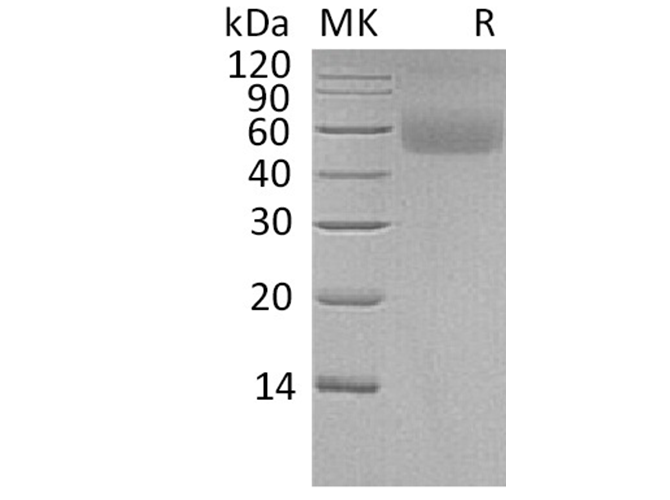 Recombinant Human LSAMP Protein (His Tag)