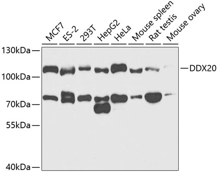 Western blot analysis of extracts of various cell lines using DDX20 Polyclonal Antibody at 1:1000 dilution.