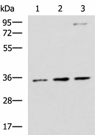 Western blot analysis of HepG2 A431 and Raji cell lysates  using STX5 Polyclonal Antibody at dilution of 1:1000