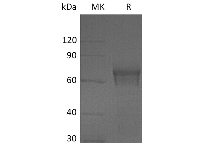 Recombinant Human IL15RA/IL-15RA Protein (Fc Tag)(Active)