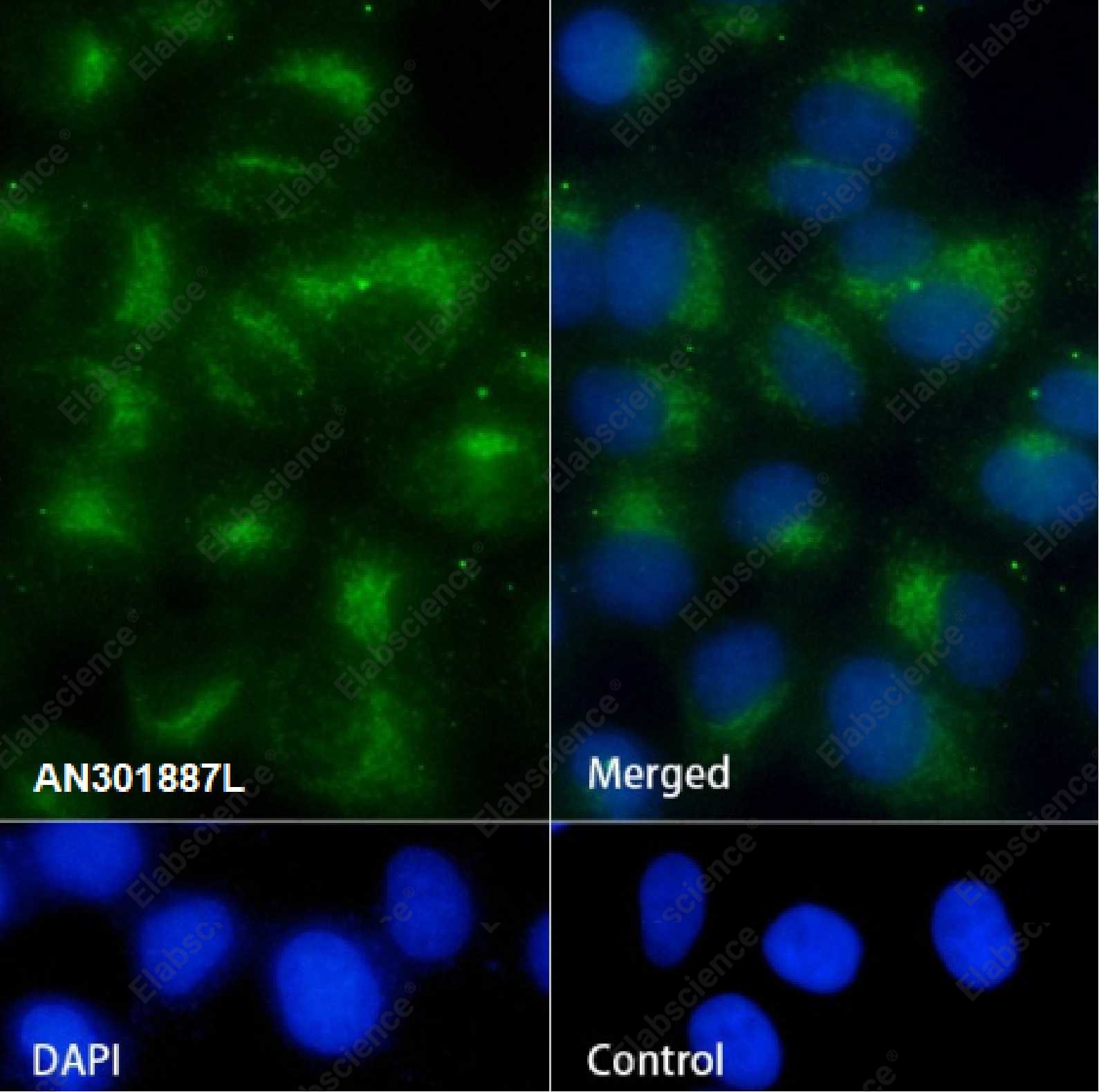 Recombinant TMEM192 Monoclonal Antibody - 3