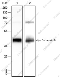 Recombinant Cathepsin B Monoclonal Antibody - 1