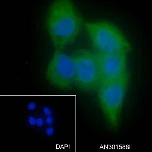Recombinant LPCAT1 Monoclonal Antibody - small - 4