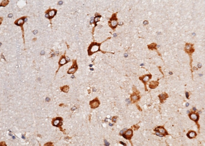 LRPAP1 Monoclonal Antibody - small - 3