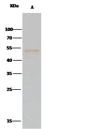 Recombinant PTP1B/PTPN1 Monoclonal Antibody - small - 2
