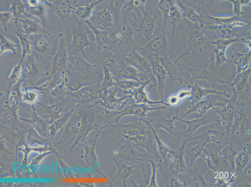 Hs 578T Cell Complete Medium - small - 6