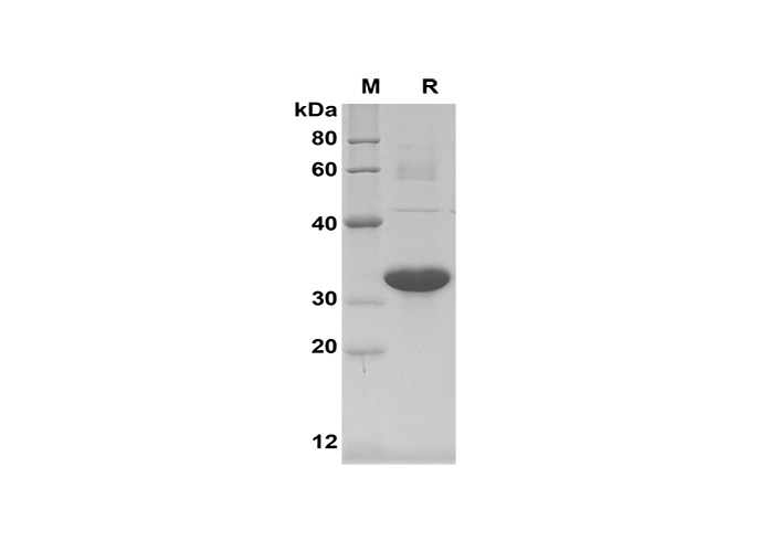 Recombinant Human IL-33 Protein(TRX Tag)-产品推荐-1