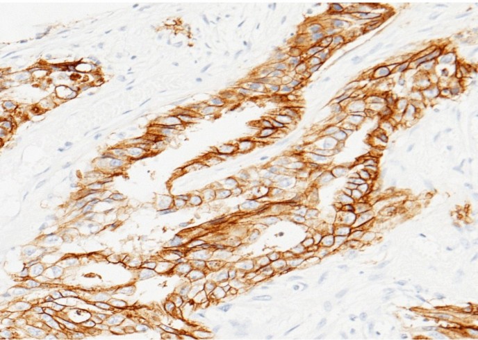 TROP2/TACSTD2 Monoclonal Antibody-searchlist-1