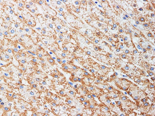Purified Anti-Human CD22 Antibody[LL2]-产品推荐-1
