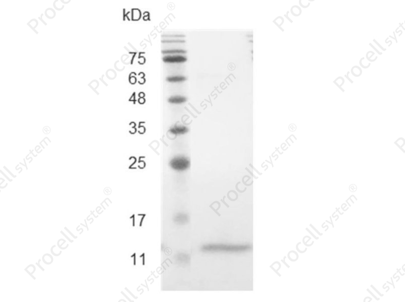 CCL4/MIP-1&beta;/ACT-2, Mouse, Recombinant