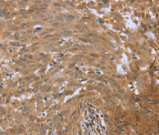 FHL2 Polyclonal Antibody - 2