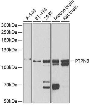 Western blot analysis of extracts of various cell lines using PTPN3 Polyclonal Antibody at 1:1000 dilution.