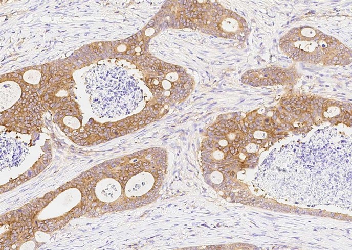 DARS Monoclonal Antibody-searchlist-1