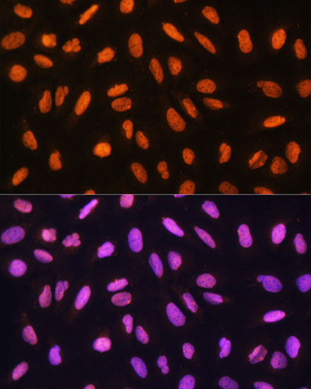 Immunofluorescence analysis of U2OS cells using GTF3C3 Polyclonal Antibody at dilution of 1:100. Blue: DAPI for nuclear staining.