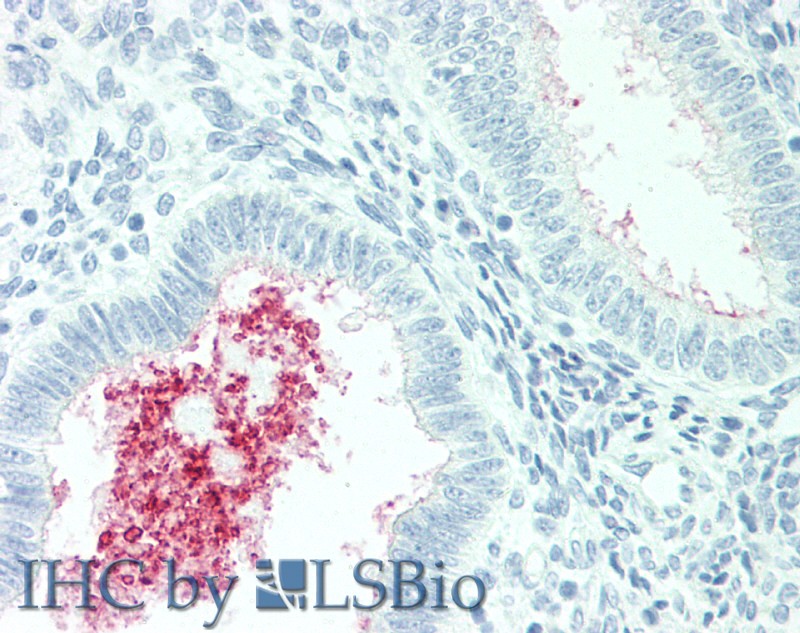 Immunohistochemistry of paraffin-embedded Human Uterus tissue using SLC34A2 Polyclonal Antibody at dilution of 1:60(Elabscience Product Detected by Lifespan).