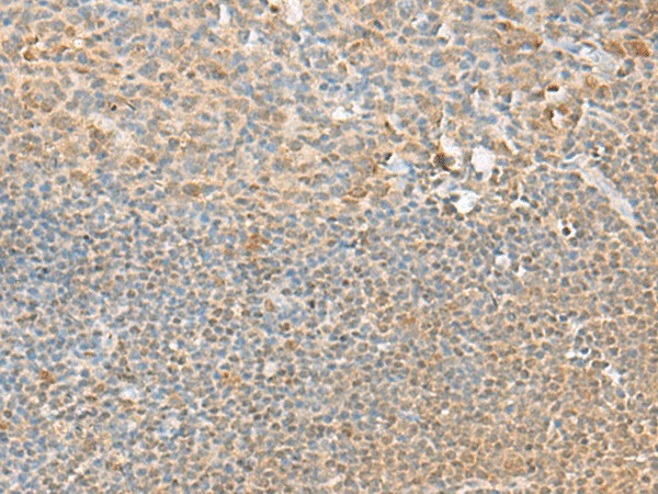 Immunohistochemistry of paraffin-embedded Human tonsil tissue  using PSMD12 Polyclonal Antibody at dilution of 1:40(?200)