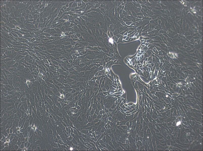NCI-H2444 Cell Complete Medium - small - 4