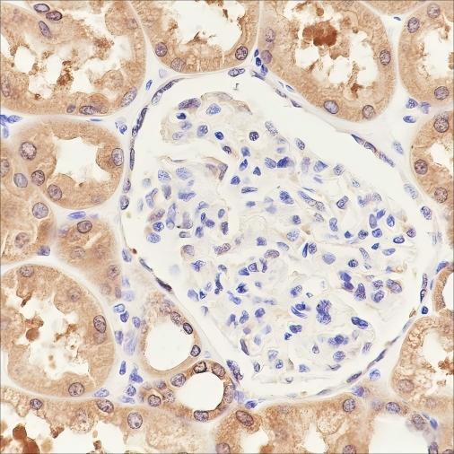 Recombinant PPM1A Monoclonal Antibody - small - 3