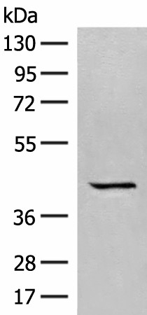 Western blot analysis of A549 cell lysate  using GPR62 Polyclonal Antibody at dilution of 1:350