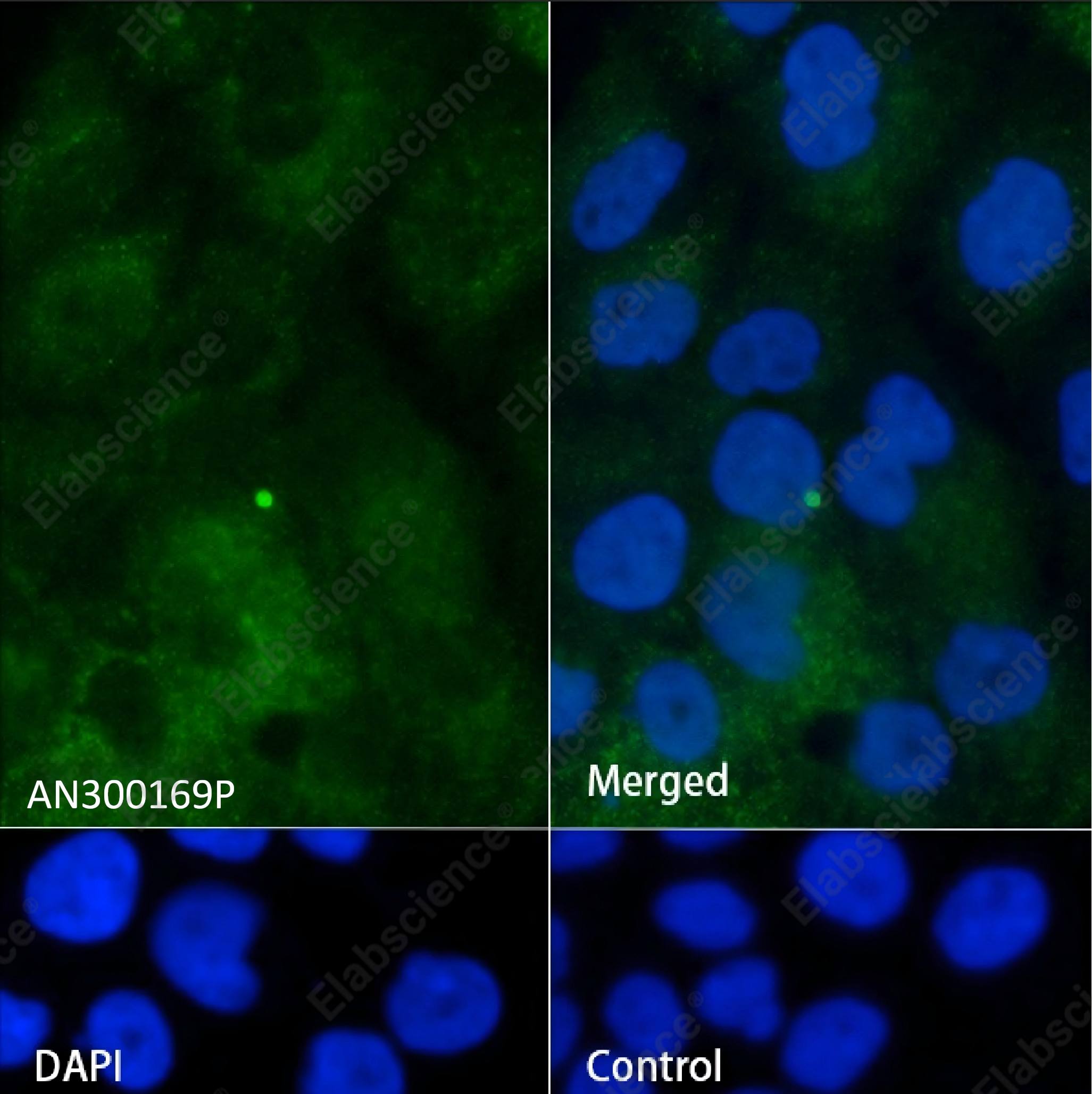 Recombinant IFITM1 Monoclonal Antibody - 4