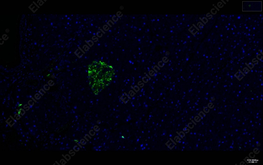 Recombinant Chromogranin A/CHGA/CGA Monoclonal Antibody - 7